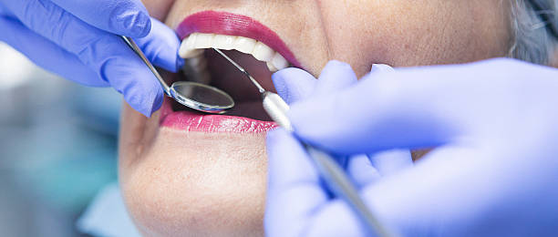 Best Broken or Cracked Tooth Emergency Dentist in Brownsburg, IN